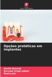 Opções OmniScriptum SRL Opções protéticas em implantes