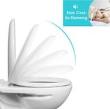 Unyqoos® abattant de toilette (forme O), blanc, PP, fermeture douce et libération rapide, antibactérien, charnières réglables en acier inoxydable (7,6–17,4 cm), 47,5×36,1 cm, capacité de charge 150 kg