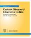 Mayo Clinic On Crohn's Disease And Ulcerative Colitis