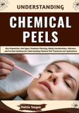 Understanding Libri GmbH Understanding Chemical Peels Paperback
