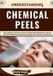 Understanding Libri GmbH Understanding Chemical Peels Paperback