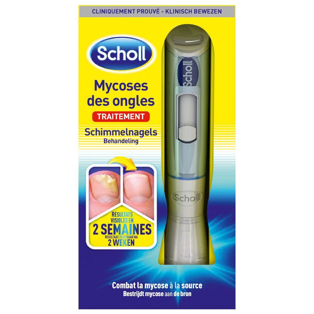 Scholl Kalknagel behandelset