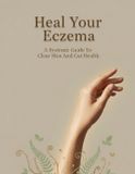 Heal Libri GmbH Heal Your Eczema Paperback