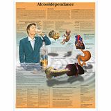 3B Scientific VR2792L Anatomisch bord, alcoho-afhankelijkheid