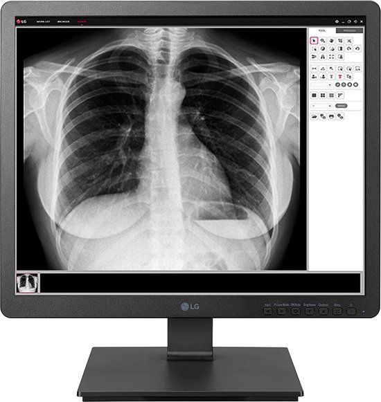 LG 19HK312C computer monitor 48,3 cm (19") 1280 x 1024 Pixels SXGA LED Zwart