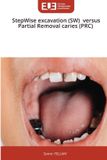 StepWise Editions Universitaires Europeennes StepWise excavation (SW) versus Partial Removal caries (PRC)