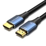 Vention ALGLI câble HDMI 1 m bleu