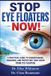 STOP Libri GmbH Stop Eye Floaters Now! Paperback