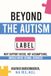 Beyond the Autism Label: Why Support Needs, Not Assumptions, Should Drive School Services
