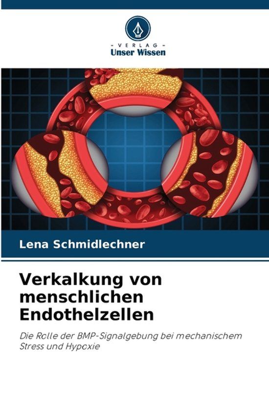 Verkalkung Verlag Unser Wissen Verkalkung von menschlichen Endothelzellen Paperback