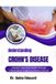 Understanding Libri GmbH Understanding Crohn's Disease Paperback