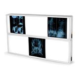 GIMA 76 x 122 cm voor radiografieplaten. TL-lamp.