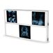 GIMA 76 x 122 cm voor radiografieplaten. TL-lamp.