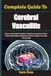 Complete Guide To Cerebral Vasculitis