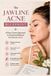 The Jawline Acne Blueprint
