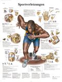 3B Scientific Gelamineerd leerbord - sportblessures