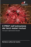 Il Edizioni Sapienza Il PRGF nell'estrazione dei terzi molari inclusi: Chirurgia e rigenerazione tissutale