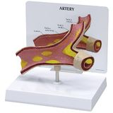 GPI Anatomicals 2600 Arterie Model