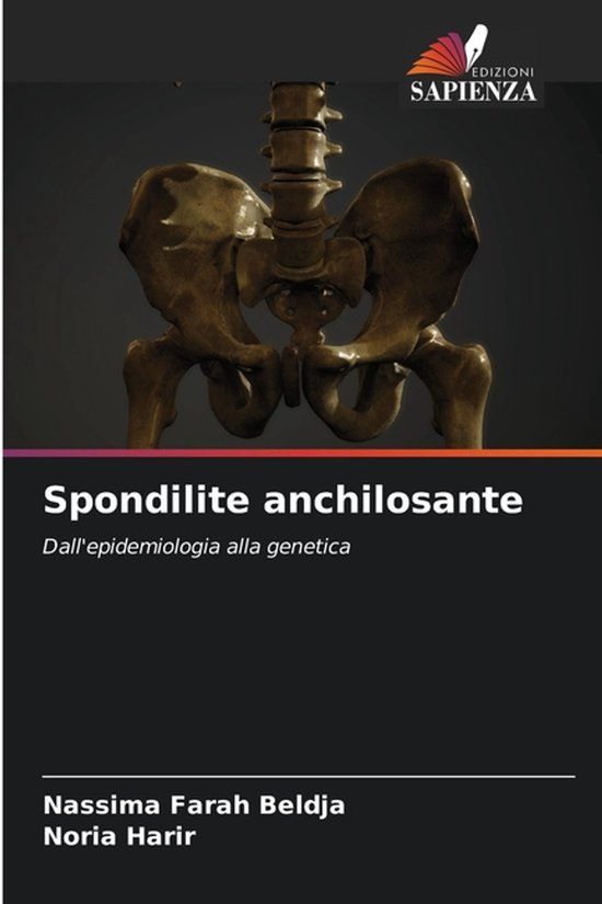 Spondilite OmniScriptum SRL Spondilite anchilosante: Dall'epidemiologia alla genetica Paperback