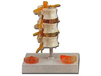 Gima - Anatomisch model van 3 wervels met hernia en verzakte schijf, zeer gedetailleerd, vergroting 1X