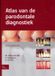 Bohn Stafleu van Loghum Atlas Atlas van de parodontale diagnostiek (Hardback)
