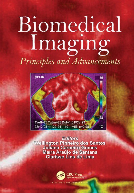 Biomedical Crc Press Biomedical Imaging: Principles and Advancements Paperback