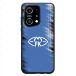 Molde FK Coque de Téléphone 3D Officiel OPPO Find X5