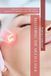 MASTERING THE MULTI-LASER: A blend of peer-reviewed evidence, manufacturer guidelines, and clinical pearls.