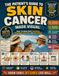 The Patient’s Guide to Skin Cancer: What to Know About Diagnosis, Treatment, Recovery, and Monitoring