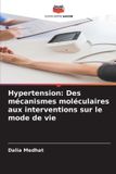 Hypertension: Editions Notre Savoir Hypertension Paperback