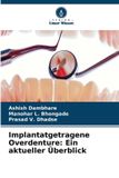 Implantatgetragene OmniScriptum SRL Implantatgetragene Overdenture
