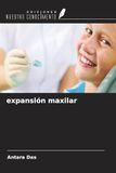 expansión OmniScriptum SRL expansión maxilar