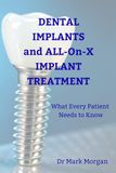 Dental Implants and ALL-on-X Implant Treatment: What Every Patient Needs to Know
