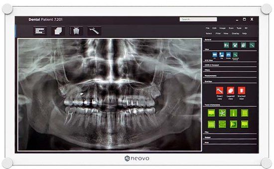 AG Neovo DR-2202 computer monitor 54,6 cm (21.5\") 1920 x 1080 Pixels Full HD LED Wit