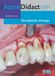 AccreDidact Parodontale chirurgie (Paperback)