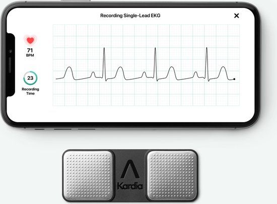 AliveCor Kardia Mobile 1-kanaals ECG meter - Zwart