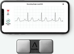 AliveCor Kardia Mobile (ECG