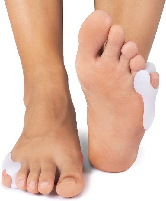 Solelution Bunionette Kleine Teen Beschermer - Zwart (Per Paar)