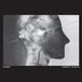 Zombi Direct Inject LP Vinyle coloré Argent
