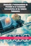 Simulación y Posicionamiento de Precisión en el Tratamiento Estereotáctico de los Tumores Pulmonares