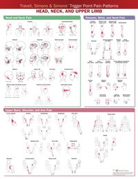 Travell, Simons & Simons’ Trigger Point Pain Patterns Wall Chart: Head, Neck, and Upper Limb