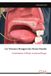 Les Libri GmbH Les Tumeurs Benignes des Fosses Nasales Paperback