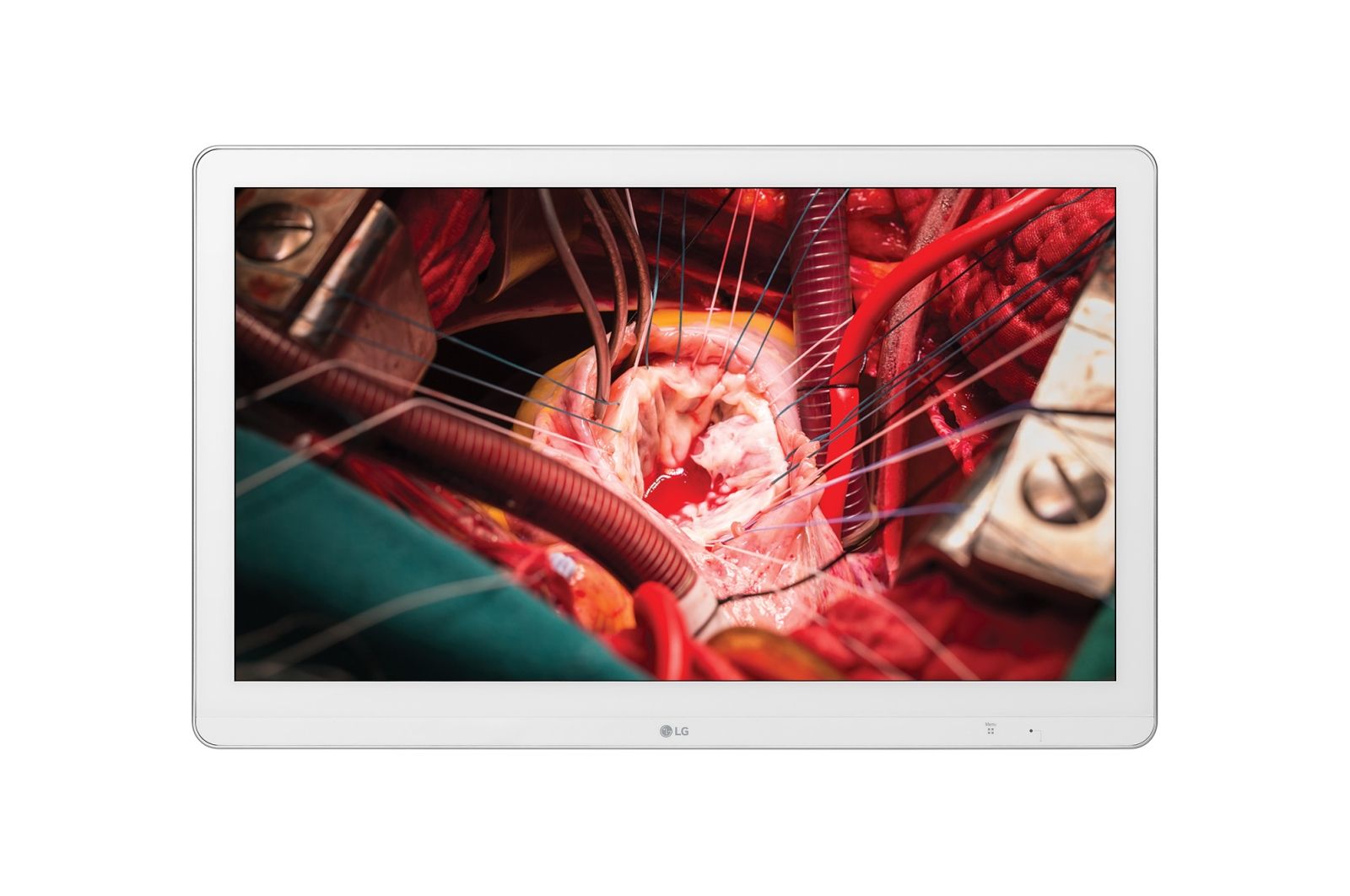 LG 27HK510S - 27" Full HD LED Monitor - IPS - White