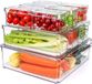 Ibenzoa® Rangement transparent pour réfrigérateur – 3 tailles, sans BPA, organisateur de garde-manger avec poignées