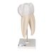 3B Scientific D10/5 High Molaire 3-delig 3B Smart Anatomy