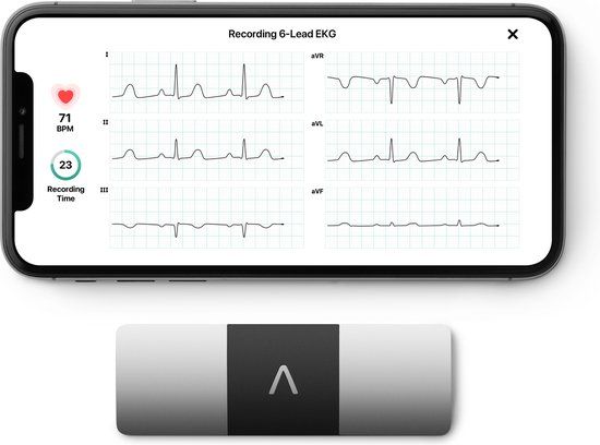 Kardia AliveCor Kardia Mobile 6L - 6-kanaals ECG monitor - Zwart