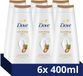 Dove Advanced Care Verzorgende Douchegel - Nourishing Care - 6 x 400ml