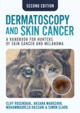 Dermatoscopy Libri GmbH Dermatoscopy and Skin Cancer, second edition