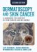 Dermatoscopy Libri GmbH Dermatoscopy and Skin Cancer, second edition