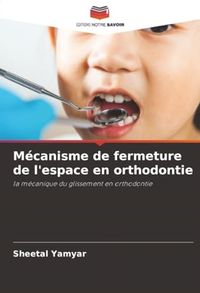 Mécanisme Icecat Mécanisme de fermeture de l'espace en orthodontie: la mécanique du glissement en orthodontie